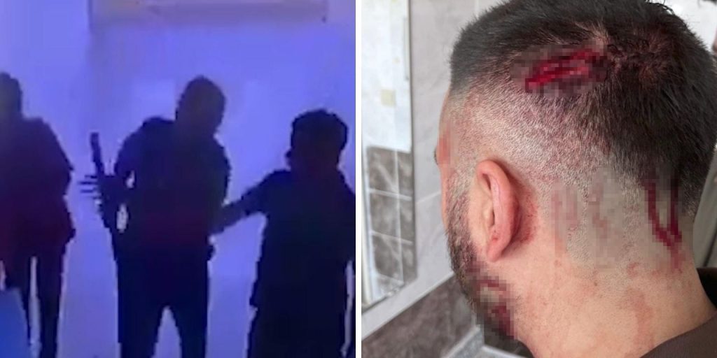 Insegnante Aggredito a Şanlıurfa: Un Atto di Violenza che Sottolinea la Necessità di Maggiore Sicurezza e Rispetto nel Sistema Educativo