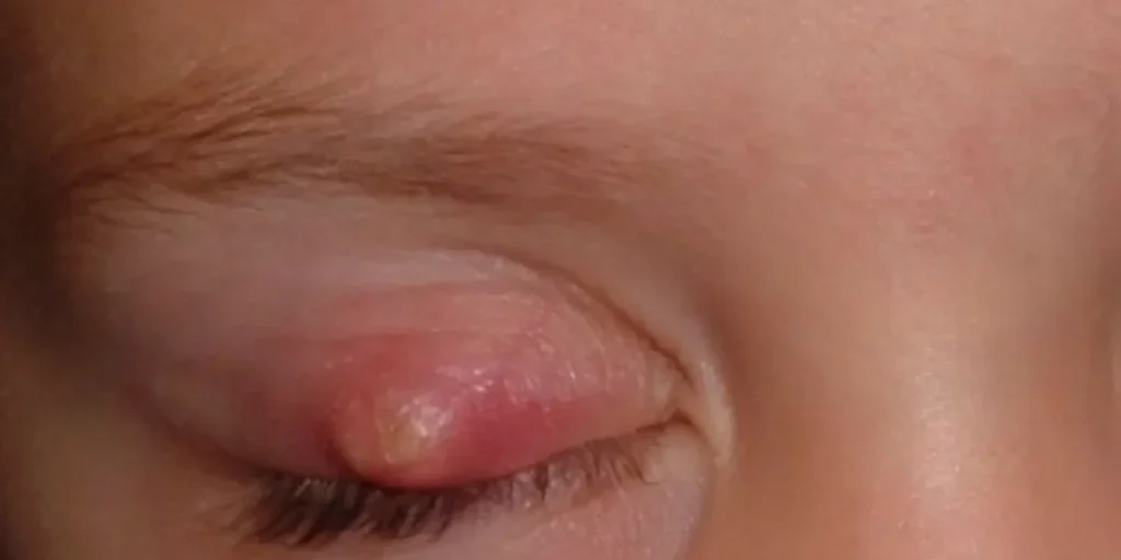 Da raffreddore a chirurgia di nove ore: la storia di un paziente