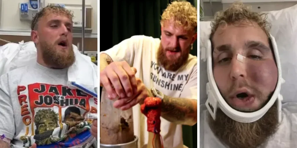 Jake Paul si frattura il mento in gara con Anthony Joshua e frulla un sandwich costoso