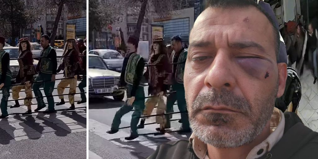 Attacco violento contro l'artista di marionette Adem Ocaktan e la sua famiglia in Turchia: un caso che solleva questioni importanti sulla violenza domestica e sul sostegno alle vittime

Introduzione
Un evento scioccante si è verificato a Kayseri, in Turchia, dove Adem Ocaktan, noto artista di marionette e fenomeno dei social media, è stato vittima di un attacco violento insieme al fratello e al figlio tredicenne.

Il fatto
Secondo le informazioni disponibili, l'aggressione è avvenuta nel luogo di lavoro di Adem Ocaktan e ha coinvolto la sua ex moglie, che è in procinto di divorziare, e altri membri della sua famiglia. Le immagini dell'aggressione sono state catturate dalle telecamere di sicurezza.

Conseguenze dell'attacco
Adem Ocaktan ha riferito che suo fratello è stato gravemente ferito nell'attacco e che suo figlio tredicenne ha subito un trauma psicologico a seguito dell'aggressione. La notizia di questo evento ha suscitato grande preoccupazione e condanna tra i fan e i sostenitori di Adem Ocaktan.

Approfondimento
L'incidente solleva questioni importanti sulla violenza familiare e sulle conseguenze psicologiche che possono derivarne, soprattutto per i minori coinvolti. È fondamentale che tali situazioni vengano affrontate con serietà e che vengano fornite adeguate misure di supporto alle vittime.

Possibili Conseguenze
Le conseguenze di questo attacco potrebbero essere lungimiranti, non solo per Adem Ocaktan e la sua famiglia, ma anche per la comunità più ampia. Potrebbero includere un aumento della consapevolezza sulla violenza domestica e sull'importanza di un sostegno adeguato per le vittime.

Opinione
È importante notare che la violenza non è mai una soluzione e che è cruciale cercare aiuto e supporto in situazioni di conflitto. La comunità deve unirsi per condannare tali atti di violenza e per offrire sostegno a coloro che ne sono stati colpiti.

Analisi Critica dei Fatti
L'analisi dei fatti rivela la necessità di un approccio più comprensivo per affrontare la violenza domestica, che include non solo il sostegno alle vittime, ma anche la prevenzione e l'educazione sulla non violenza.

Relazioni con altri fatti
Questo incidente si inserisce in un contesto più ampio di violenza domestica e di abusi che avvengono in tutto il mondo. È importante riconoscere che tali eventi non sono isolati e che richiedono un'attenzione e un impegno collettivi per essere prevenuti.

Contesto storico
La violenza domestica è un problema che affligge le società da secoli, con radici profonde nella cultura e nelle strutture sociali. Affrontare questo problema richiede un cambiamento culturale e sociale profondo.

Fonti
La fonte di questo articolo è Hurriyet. Per ulteriori informazioni, si prega di visitare il sito web ufficiale della fonte.