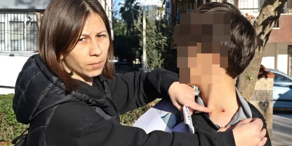 Bullismo in una scuola di Antalya: alunno ferito, madre denuncia la scuola