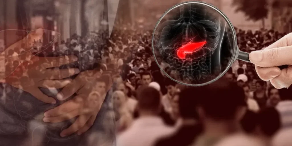 Pancreas cancer: 15 milioni di fumatore in Turchia a rischio di tumore silenzioso