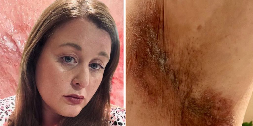 Ünlü markanın deodorantı ciltlerini yaktı! Yüzlerce kadın kabusu yaşadı