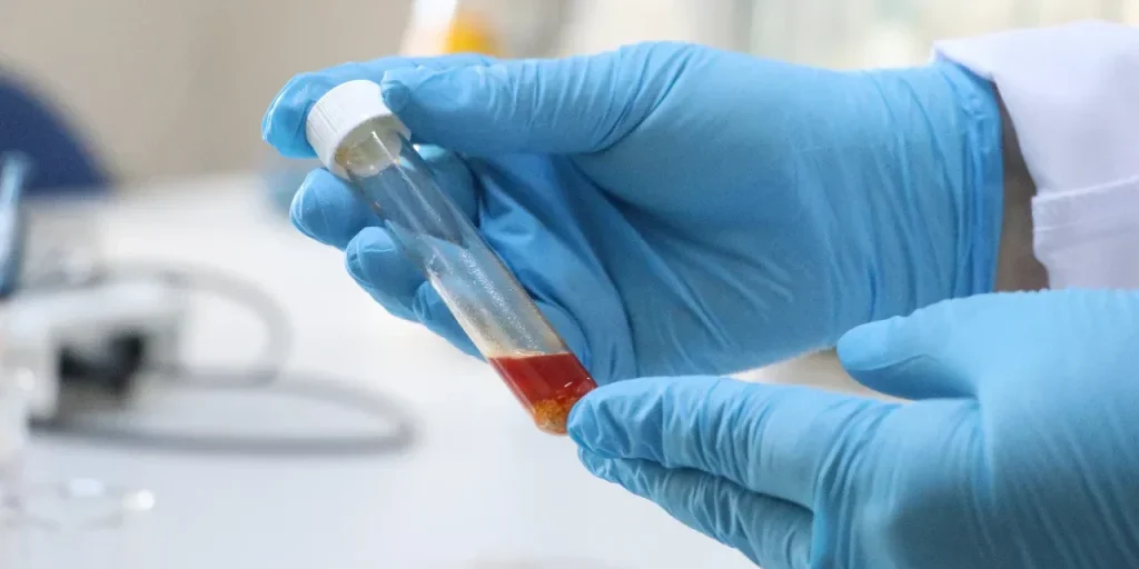 Olio a singola cellula ottenuto dalla polpa residua dell'uva: innovazione sostenibile