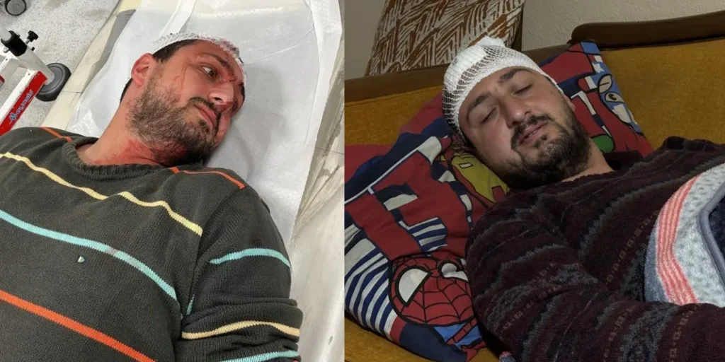 Violenza contro ragazzo autistico a Kocaeli: aggressore arrestato