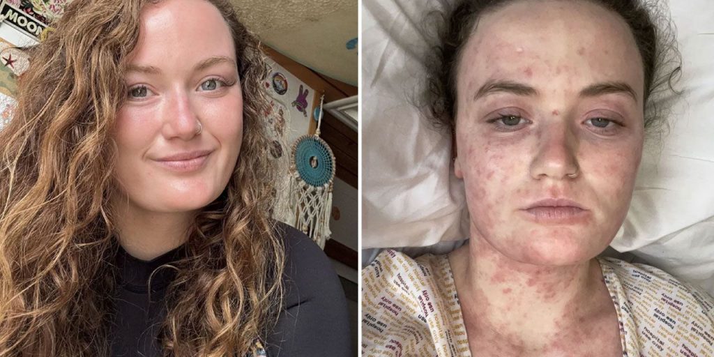 Yoğun sırt ağrısı alarm verdi, saatler içinde kötüleşti! Yanlış teşhis az kalsın canından ediyordu